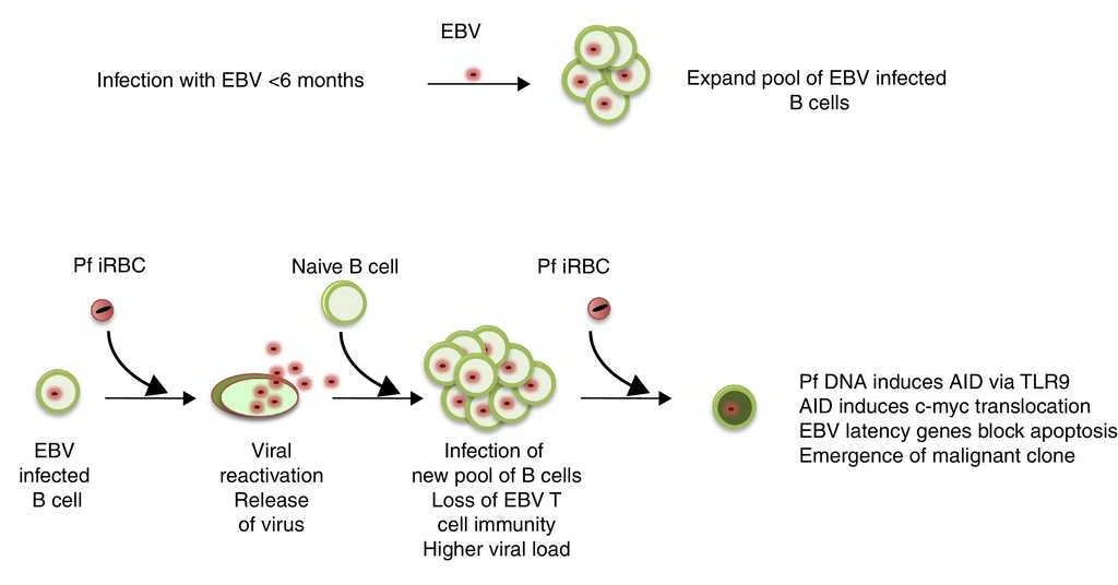 epstein-barr-virus-infection-of-infants-implications-of-early-age-of