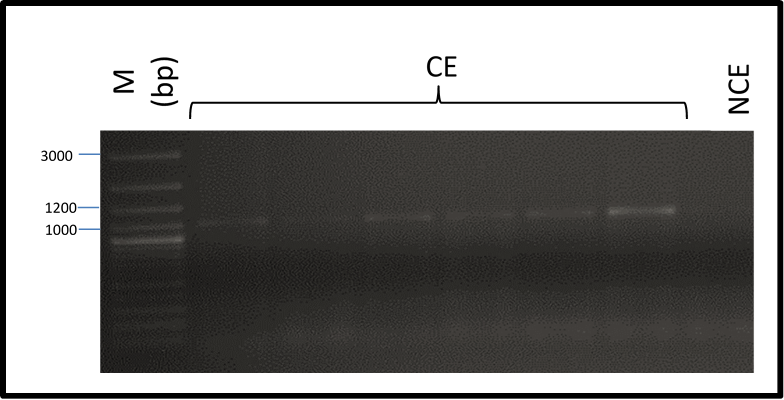 Molecular Insights Into Somatic Embryogenesis In Agave Angustifolia