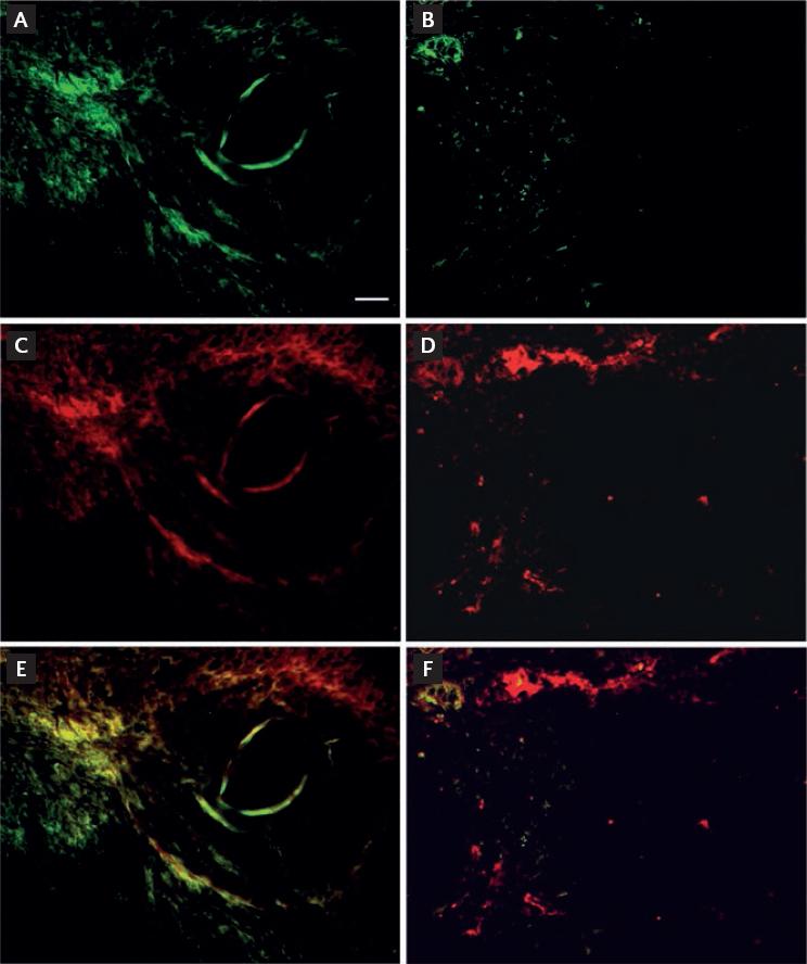 An Epidermal Growth Factor Motif Of Developmental Endothelial Locus