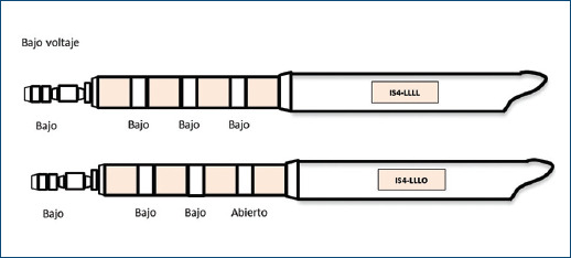 Guía Para Identificar Características Específicas En Dispositivos De