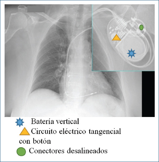 Guía Para Identificar Características Específicas En Dispositivos De