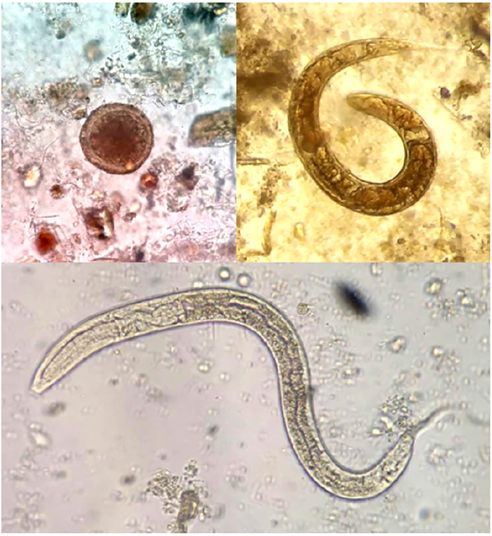 Zoonotic parasites in dog feces from Leon, Mexico