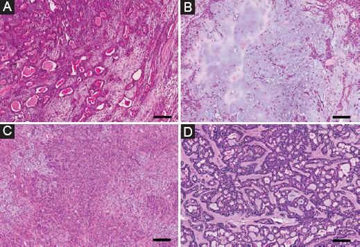 Cellularity and its relation with capsular characteristics as an ...