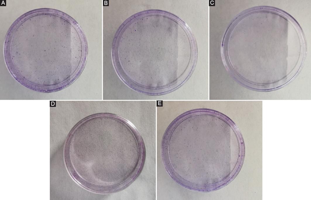 Activation hypoxia inducible factor-1α gene affected the tumor ...