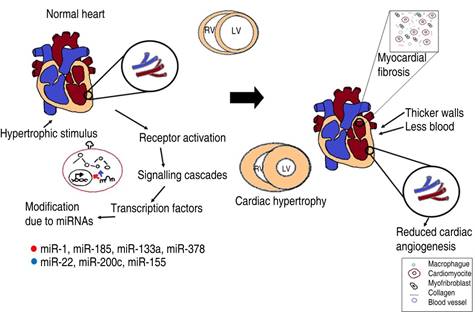 The role of microRNAs in the development of heart failure