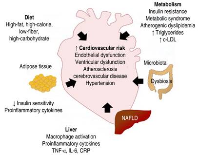 Dyslipidemias, Fatty Liver, And Cardiovascular Disease