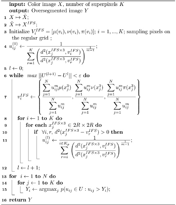 Superpixels extraction by an Intuitionistic fuzzy clustering algorithm