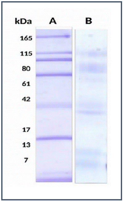 Partial Characterization Of The Potentially Bioactive Protein Fraction ...