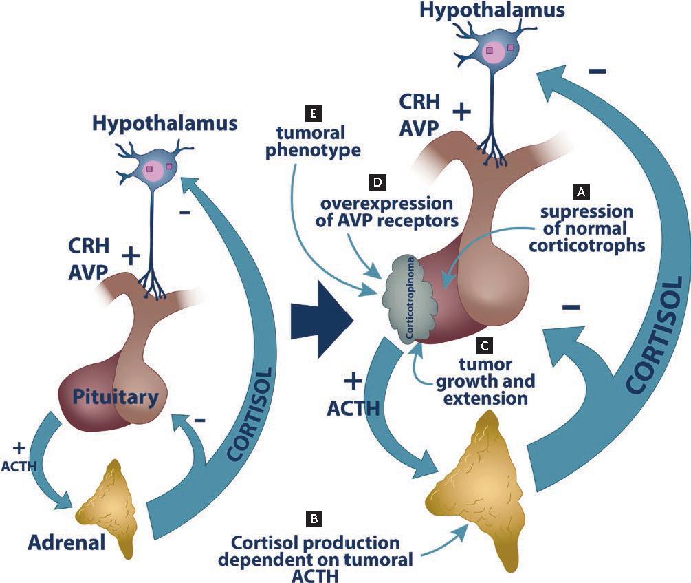 determinants-of-clinical-behavior-and-prognosis-in-cushing-s-disease-a