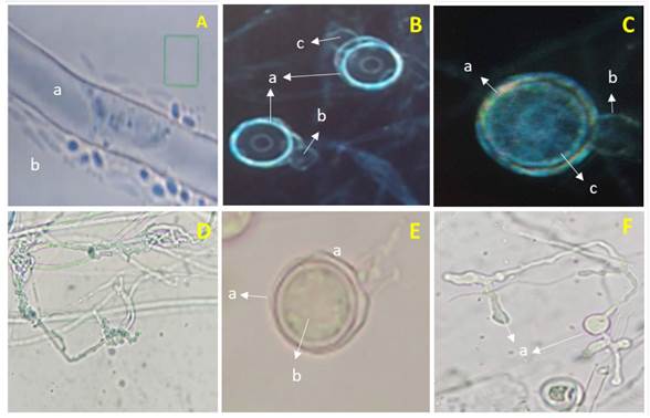 Characterization and pathogenicity of a Pythium aphanidermatum isolate ...