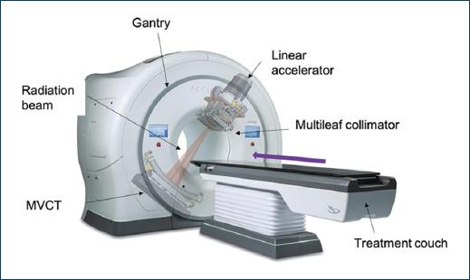 Helical tomotherapy: advanced radiotherapy technology