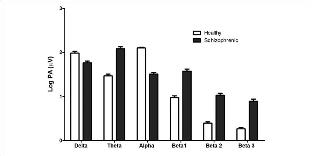 electroencephalographic-activity-during-sentence-production-in-healthy