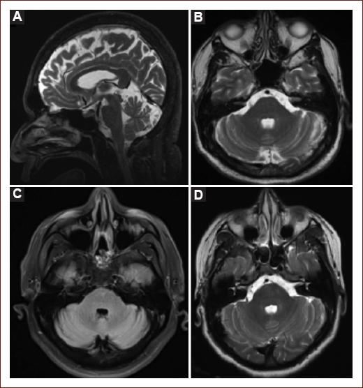 Frequency, clinical, and paraclinical characteristics of patients with ...