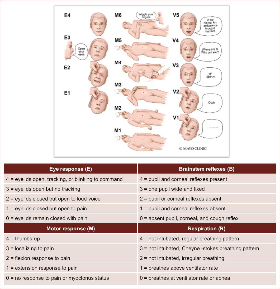 Semiology of the neurocritical patient: understanding the language of ...